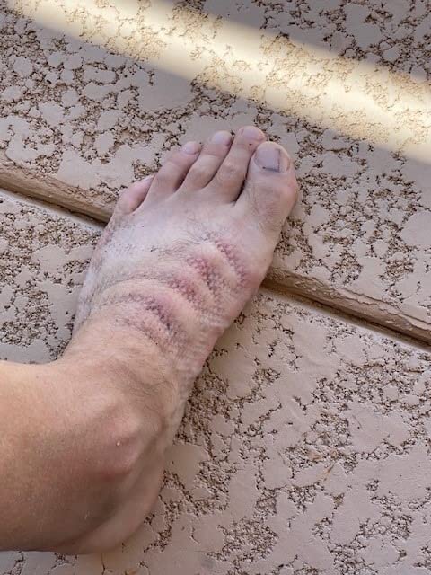 B07TDYZJWR Customer Photo 1