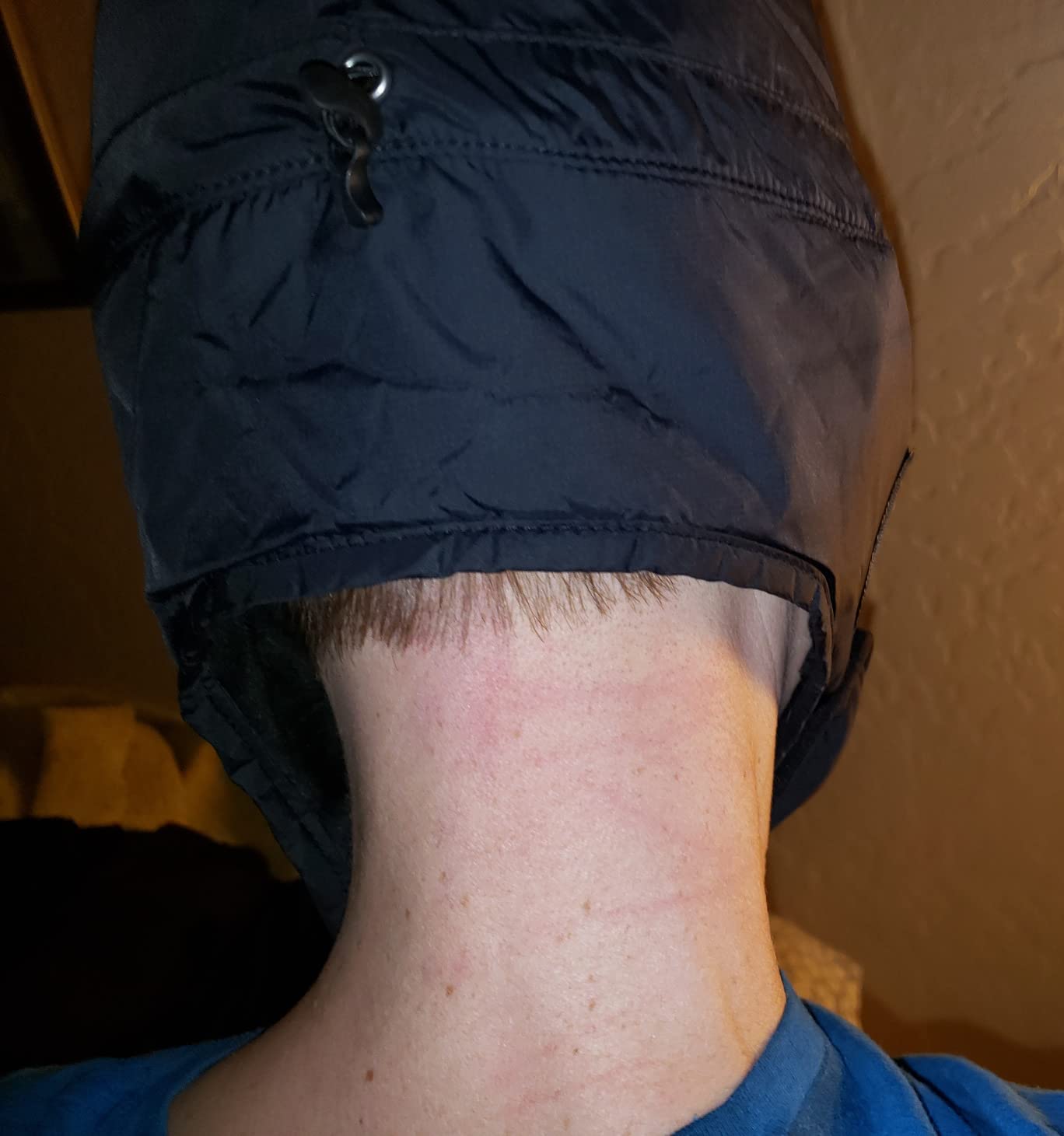 Outdoor Research Frostline Hat - Customer Photo 1